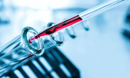 HCT (hematokrit) nedir, değeri kaç olmalıdır HCT düşüklüğü ve yüksekliği hakkında bilgiler