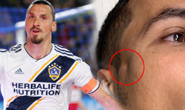 Ibrahimovic rakibini hastanelik etti