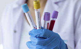 Eskişehirde ‘Kovid-19’ iddiasına yalanlama