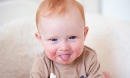 Anne ya da babası alerjik olan çocuklar daha riskli