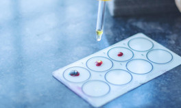 Kan Grubunuz Kişiliğinizi Söylüyor