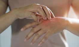 Aşırı dezenfektan kullanımı ellerde egzamaya davetiye çıkarıyor