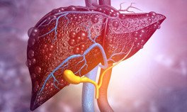 Karaciğer yağlanmasına dikkat Bu belirtiler varsa siz de risk altındasınız