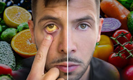  Bu besinler cildinizin rengini değiştiriyor Hangi yiyecekler hangi renkleri veriyor