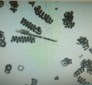 Sazlıdere Barajındaki endişelendiren görüntüye açıklama