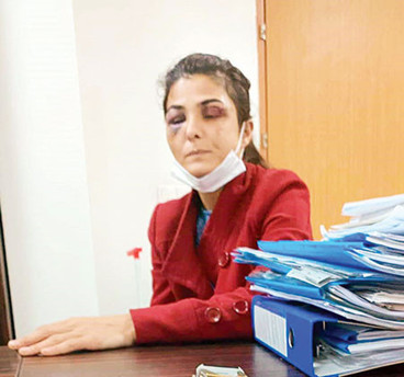 Maklubeci tosun marulcu olmuş