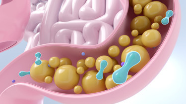 Ultra işlenmiş gıdalar bağırsak sağlığını nasıl etkiliyor Gerçekten kanserle bir ilişkisi var mı