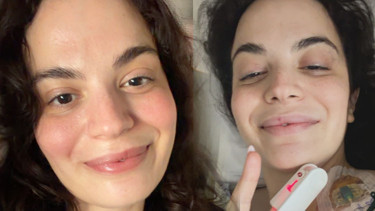 Aslı Bekiroğlu 7. kez ameliyat oldu