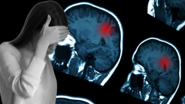 Migren dediler, birkaç hafta ömrü kaldığı ortaya çıktı Genç kız şimdi yaşam savaşı veriyor