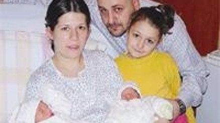 Anne karnında ameliyat edilen ikizler doğdu