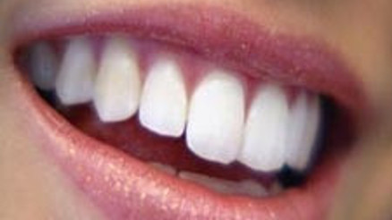 Hollywood Gülüşü