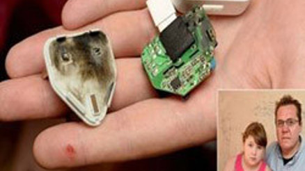 iPad şarjı elinde patladı