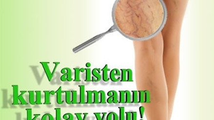 Varis nedir, nasıl oluşur, nasıl giderilir