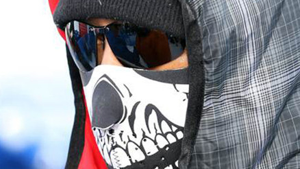 Ünlü Golfçu kamera yüzünden dişinden oldu