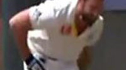 X-Man canevinden vuruldu