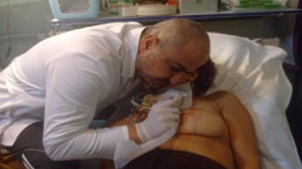 Kanserin aldığı memeye dövmeden meme ucu Kanserin aldığı memeye dövmeden meme ucu