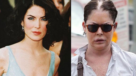 Gösteri dünyasının kötü yaş alan ünlüleri