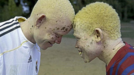 Öldüren değil yaşatan derbi