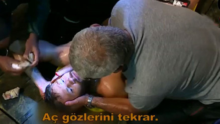 Survivor 2016da şoke eden olay Yarışmayı bırakmak zorunda mı kalacak Survivor 2016da şoke eden olay Yarışmayı bırakmak zorunda mı kalacak