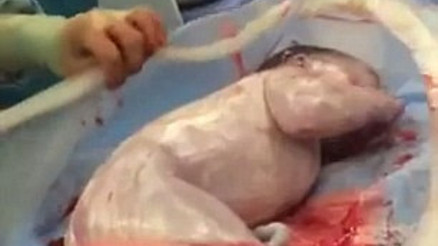 Bebek kendi elleriyle doğdu