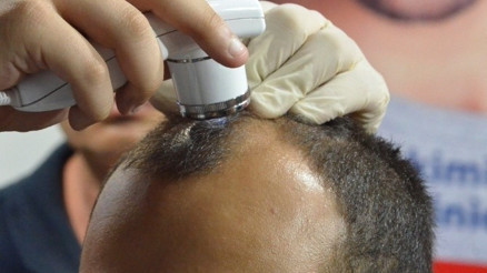 Saçlarınızdaki Dökülmeye Son Verin