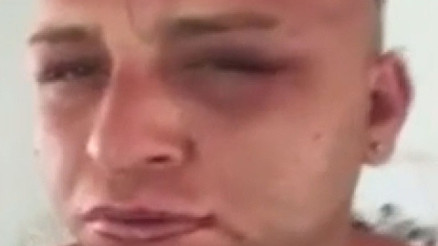 Survivor Taneri 15 kişi dövdü