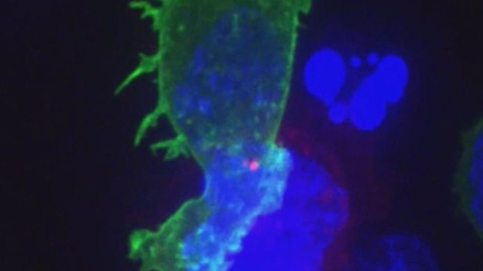 Kanser hücrelerinin yok edilmesi mikroskopla görüntülendi