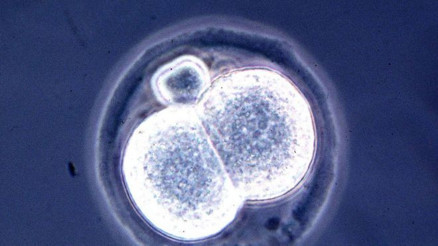İlk kez yapay embriyo üretildi