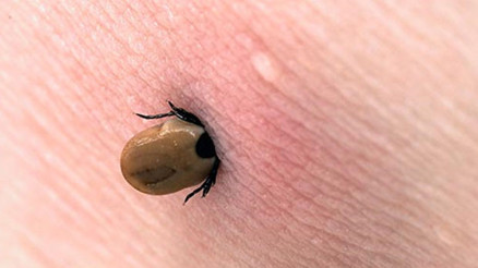 Lyme hastalığı nedir Lyme hastalığı belirtileri nelerdir