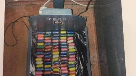 Midesinden 82 kapsül kokain çıkan Ukraynalıya  45 yıl hapis istemi