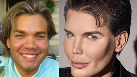 Meğer amacı Kene benzemek değilmiş