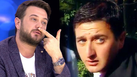 Onur Büyüktopçu: Burun estetiği yaptırdım