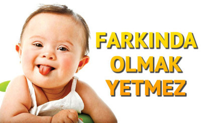47 kromozomlu bir mucize