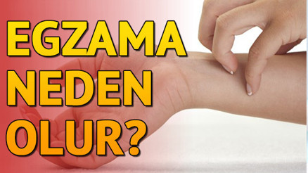 Egzama nedir Neden olur ve nasıl geçer