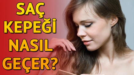 Saç kepeğine ne iyi gelir ve nasıl geçer Saç kepeği neden olur Evde saç kepeğini geçiren bitkisel çözümler ve doğal yöntemler