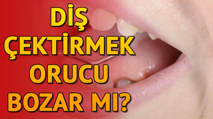 Diş çektirmek orucu bozar mı Oruçluyken diş çektirilir mi