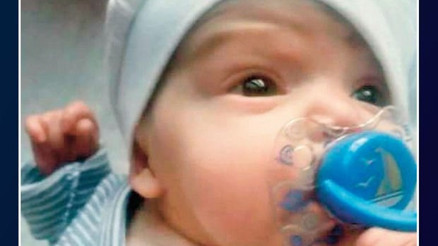 Dünyada bu hastalığı yaşayan 10uncu bebek... Tek çaresi var