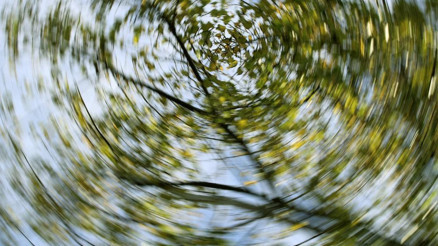 Vertigo nedir Vertigo belirtileri nelerdir Vertigo nedir Vertigo belirtileri nelerdir