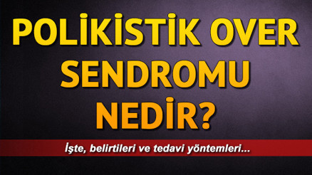 Polikistik over sendromu nedir Polikistik over sendromu belirtileri neler Polikistik over sendromu nedir Polikistik over sendromu belirtileri neler