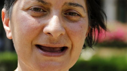 Tüm dişlerini kaybeden Öztürk: Acı içinde yaşıyorum