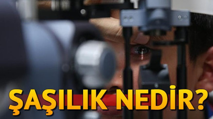 Şaşılık nedir Şaşılık tedavisi nasıl yapılır