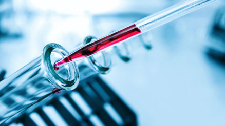 HCT (hematokrit) nedir, değeri kaç olmalıdır HCT düşüklüğü ve yüksekliği hakkında bilgiler