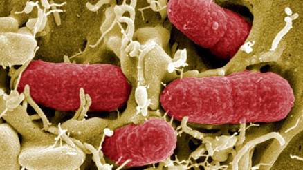 Rota virüsü nedir Rota virüsü enfeksiyonu