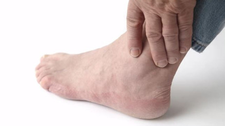 Gut hastalığı nedir, nasıl anlaşılır Gut hastalığı nedir, nasıl anlaşılır