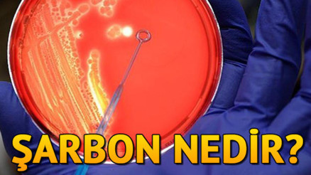 Şarbon hastalığı ne demek Şarbon belirtileri nasıl ortaya çıkar Şarbon hastalığı ne demek Şarbon belirtileri nasıl ortaya çıkar