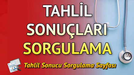 MHRS tahlil sonuçları nasıl sorgulanır