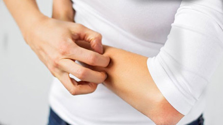 Egzama nedir Egzama bulaşıcı mıdır Egzama nedir Egzama bulaşıcı mıdır