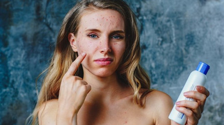 Akneli Yüz Haritası: Çenede, alında, burunda, yanaklarda, kulaklarda, saç çizgisinde ve kaşta sivilce neden çıkar Akneli Yüz Haritası: Çenede, alında, burunda, yanaklarda, kulaklarda, saç çizgisinde ve kaşta sivilce neden çıkar