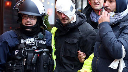 ABye çifte standart suçlaması ABye çifte standart suçlaması