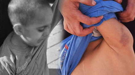 Skandal iddia: 5 yaşındaki zihinsel engelli çocuğa okulda şiddet